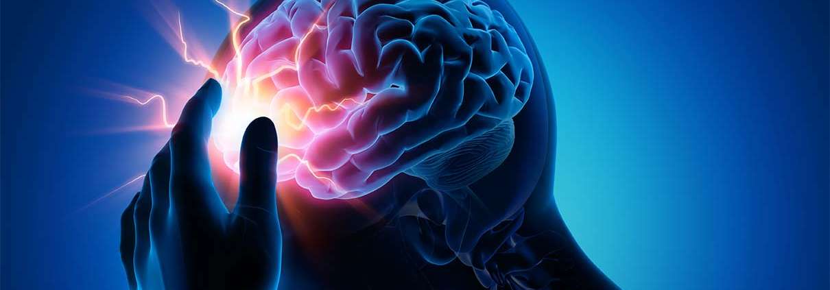 Grafische Darstellung eines Kopfes in Blau gehalten, das Gehirn leuchtet in heller Farbe und symbolisiert so die Diagnose Schlaganfall.